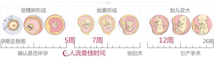 无痛人流什么时候做好呢?(图2) 无痛人流什么时候做好呢?(图2)